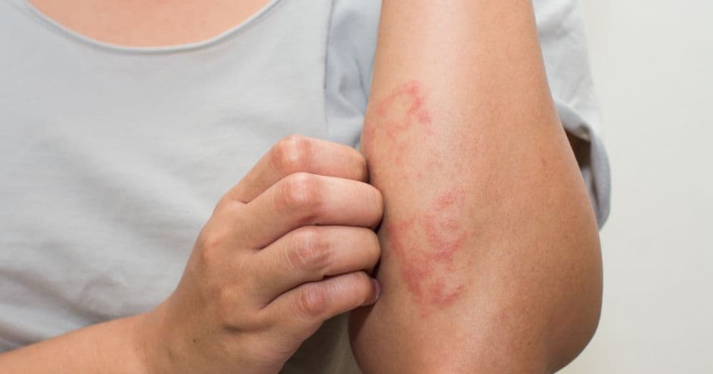 Soin énergétique pour eczéma et psoriasis à Nantes avec Steven Patron Da Lage