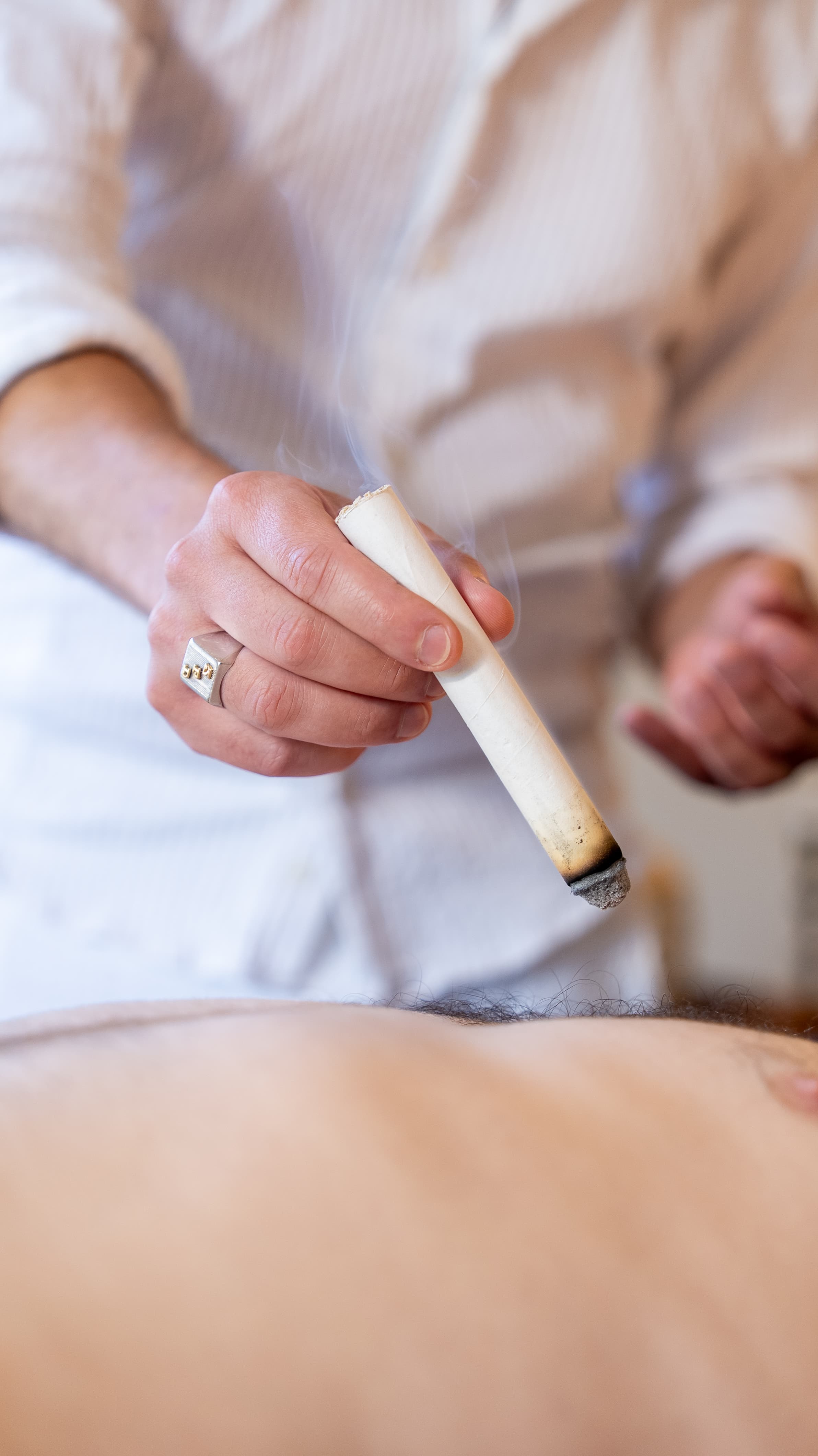 Moxibustion