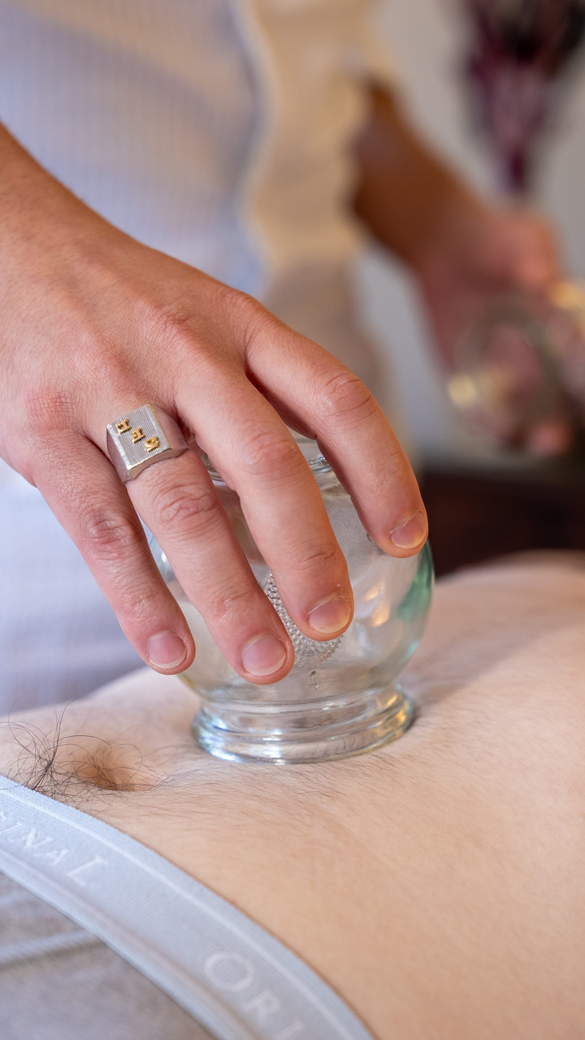 Les ventouses — Technique du Cupping